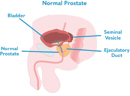 Normal Prostate Diagram.jpg