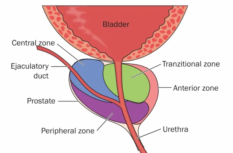 The zones of the prostate displayed on a medical illustration.