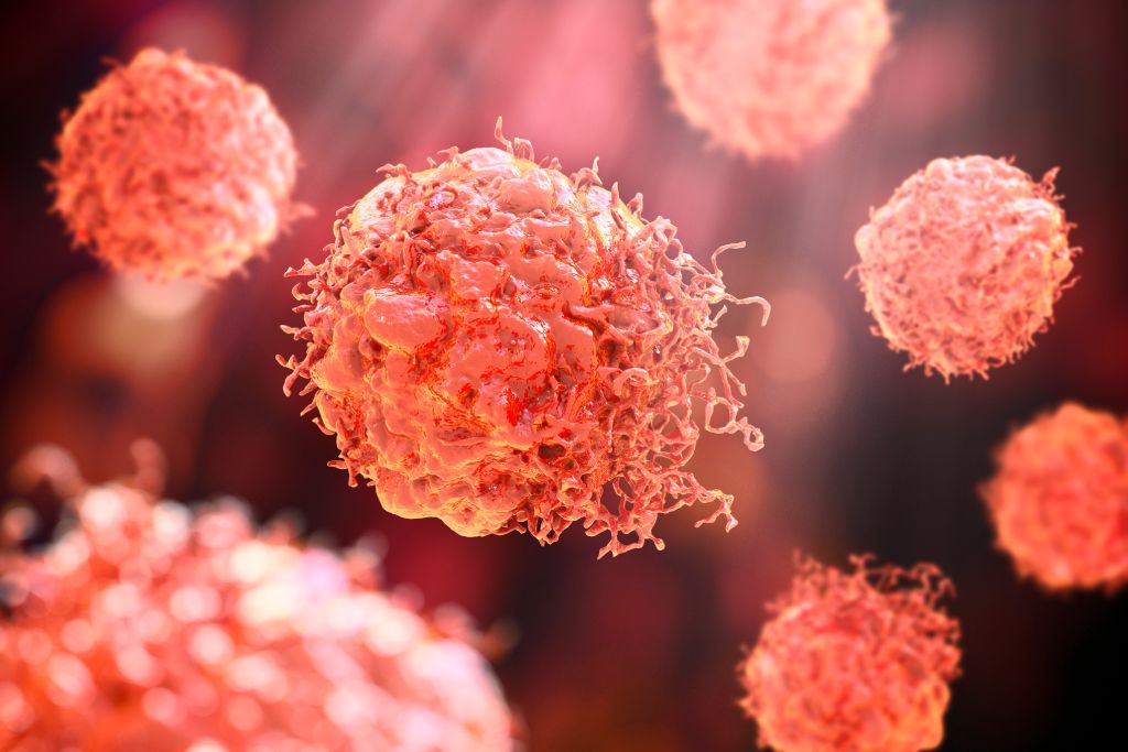 A 3D rendering shows cancerous cells.