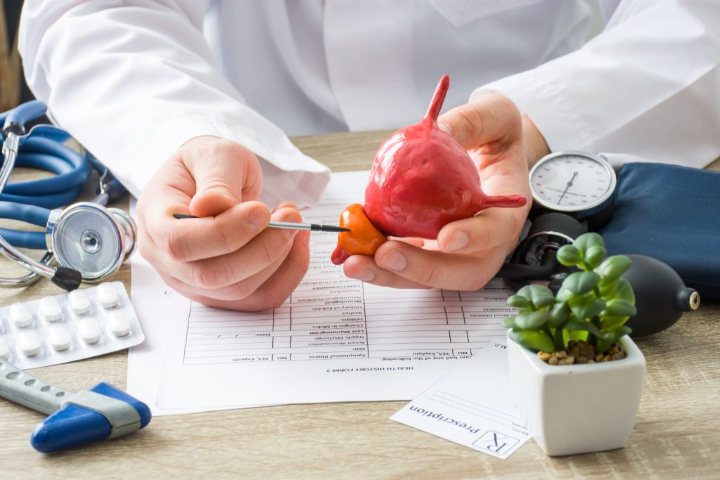 A physician uses a pen to point to the prostate on a model of the gland and the bladder above it.