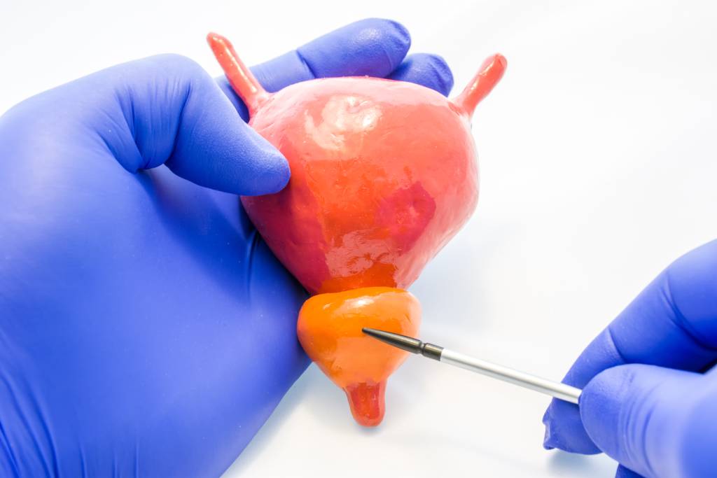 A physician holds a model of the prostate and bladder, pointing to the prostate gland with a pen.