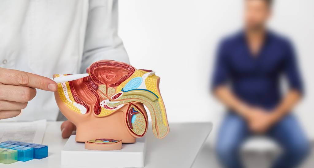 A physician points to the prostate on an anatomic model of the area.